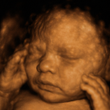 ultrasound 2