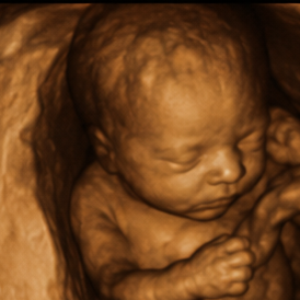 ultrasound 3