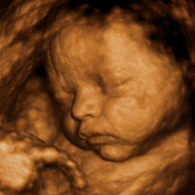 ultrasound picture 1